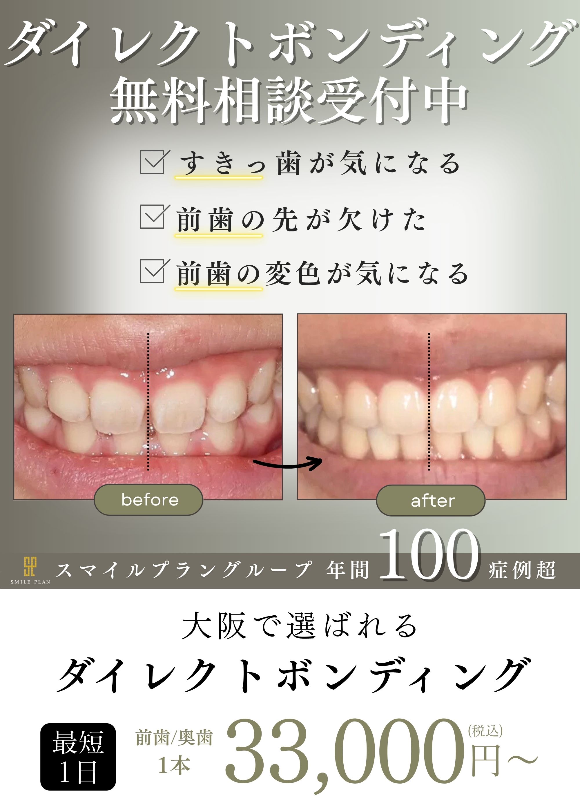 大阪・なんばのダイレクトボンディング名医