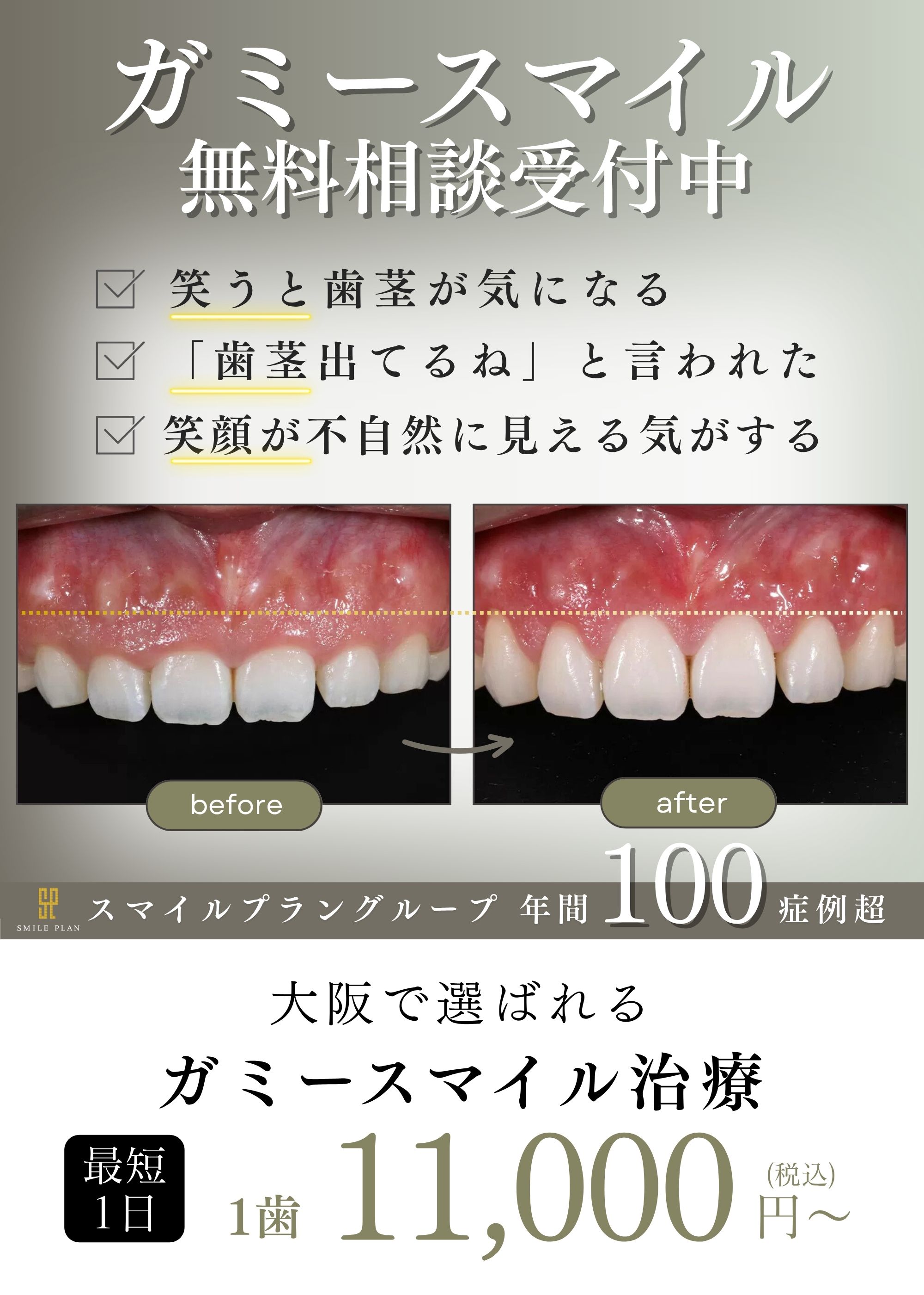 大阪・なんばのガミースマイル名医・最短1日1万円